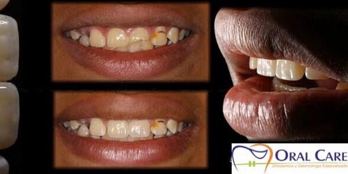 ORAL CARE 