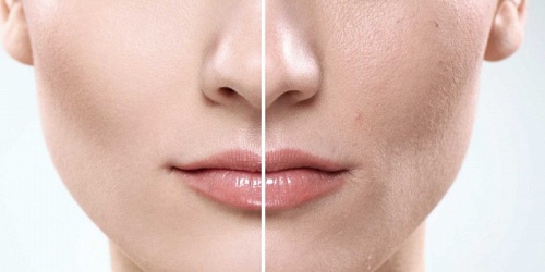 CENTRO DERMATOLÓGICO FIGURA PIEL & LÁSER