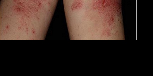 CENTRO DERMATOLÓGICO FIGURA PIEL & LÁSER