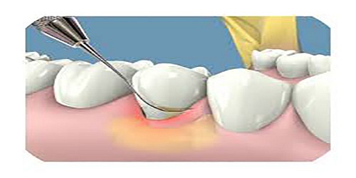 Clinicas Odontologicas Elite Dental