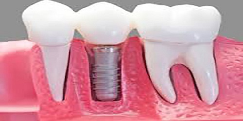Clinicas Odontologicas Elite Dental