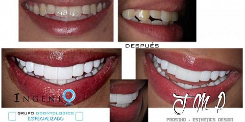 Ingenio Grupo Odontologico