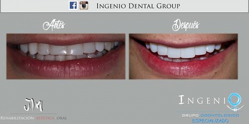 Ingenio Grupo Odontologico