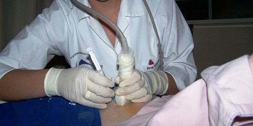 Dra. Karina Terán Q. RADIODIAGNOSTICO