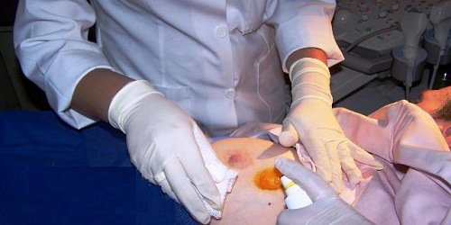 Dra. Karina Terán Q. RADIODIAGNOSTICO