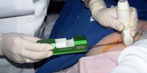 Dra. Karina Terán Q. RADIODIAGNOSTICO