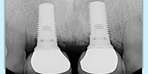 ORAL ESTUDIO - RICARDO BENAVIDES