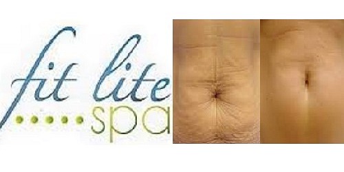 Fit Lite Spa