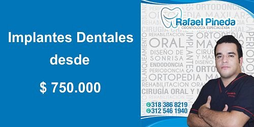 RAFAEL PINEDA ODONTOLOGIA ESPECIALIZADA
