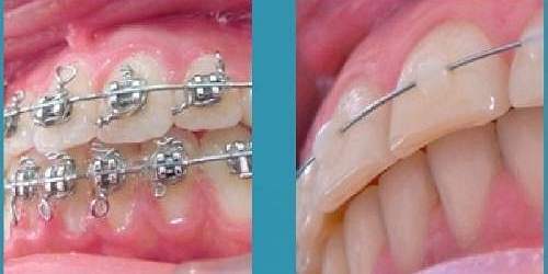 CLÍNICA ODONTOLÓGICA ORTOSONRIE