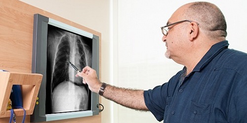 Dr. Manuel Viteri Acayturri - Asmalergia