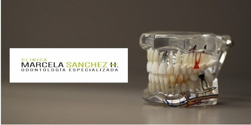CLINICA MARCELA SANCHEZ H ODONTOLOGIA ESPECIALIZADA CALI