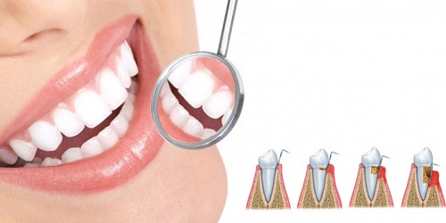 INNOVA DENTAL - Dr. Pedro Loor Crespo