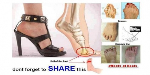 JJ Britz Orthotics & Prosthetics