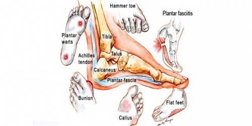 JJ Britz Orthotics & Prosthetics