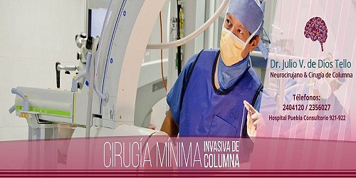 Cirujano de Columna en Puebla Dr. Julio De Dios Tello 