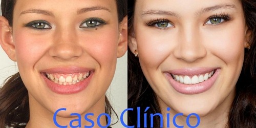 DR. NESTOR J GOMEZ GOMEZ - Odontología de Avanzada