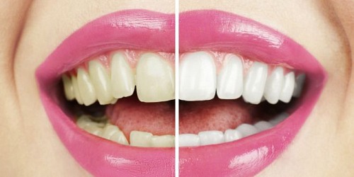 DR. NESTOR J GOMEZ GOMEZ - Odontología de Avanzada