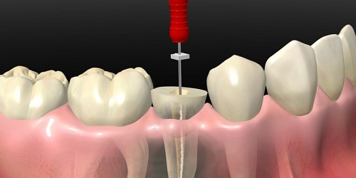 DR NESTOR J GOMEZ GOMEZ - Odontología de Avanzada