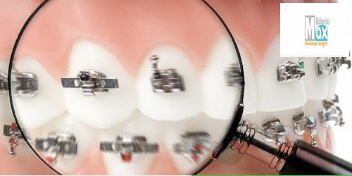 ODONTOMAX