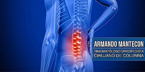 Cirujano de Columna en Cancún Dr. Armando Mantecon