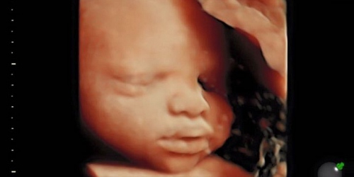 DRA. MELISSA BATISTA VEGA GINECOLOGA OBSTETRA ECOGRAFISTA
