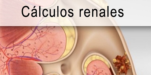 NEFRÓLOGOS EN CANCÚN DR. JOSUÉ MOLINA RUIZ