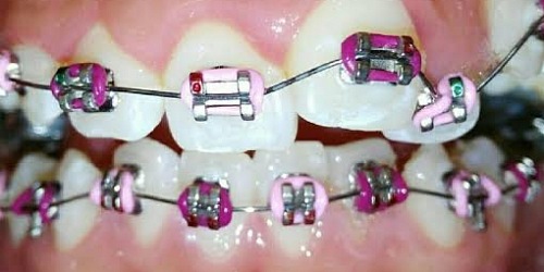 ORTHODONTICS DENTAL PRO en LOS MOCHIS, SINALOA