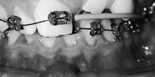 ORTHODONTICS DENTAL PRO en LOS MOCHIS, SINALOA