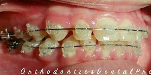 ORTHODONTICS DENTAL PRO en LOS MOCHIS, SINALOA