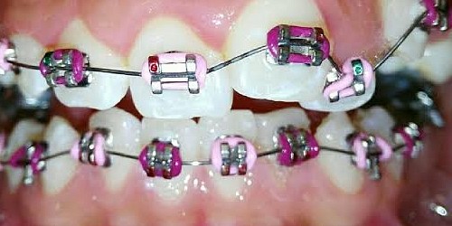 ORTHODONTICS DENTAL PRO en LOS MOCHIS, SINALOA
