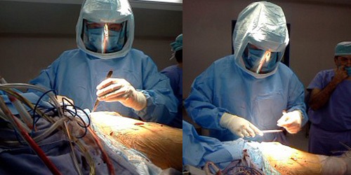 PROTESIS DE CADERA Y RODILLA EN CANCUN DR. LUIS GARCIA ANAYA