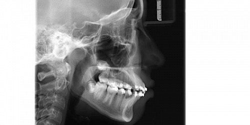 Radiografias Orto Max Acacias