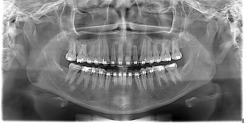 Radiografias Orto Max Acacias