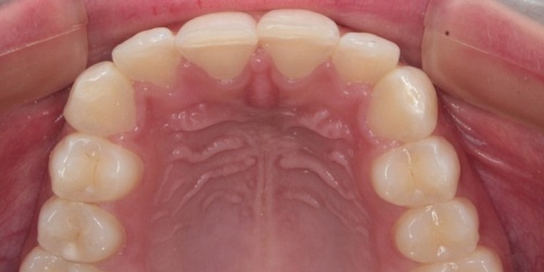 Radiografias Orto Max Acacias