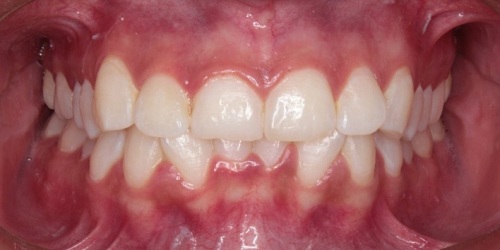 Radiografias Orto Max Acacias