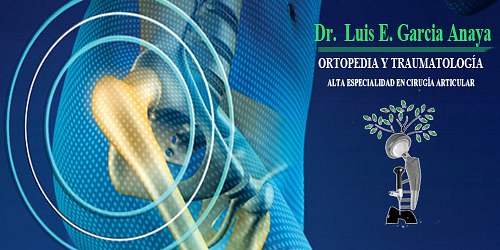 PROTESIS DE CADERA Y RODILLA EN CANCUN DR. LUIS GARCIA ANAYA