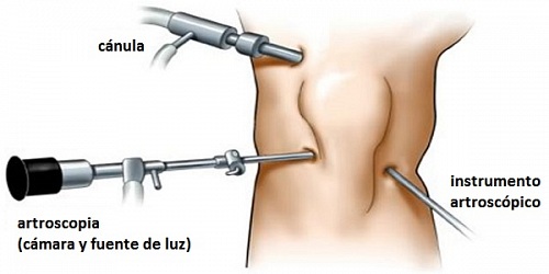 Dr. Eduardo Bilbao (Traumatólogo)