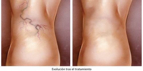 Dr. Hugo Román P. CIRUJANO VASCULAR