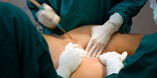 JACOBO PEREZ MD CIRUJANO GENERAL