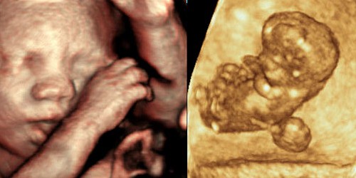 Dra. Jacqueline Baca GINECOLOGIA Y OBSTETRICIA