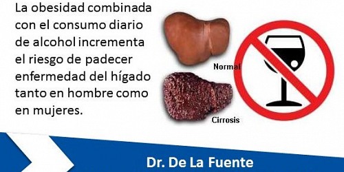 DR. DE LA FUENTE MÉDICO CIRUJANO - CIRUGÍA BARIATRICA