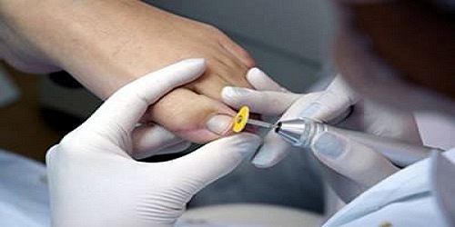 Podóloga: Consulta, Diagnostico y Exploración Podológica