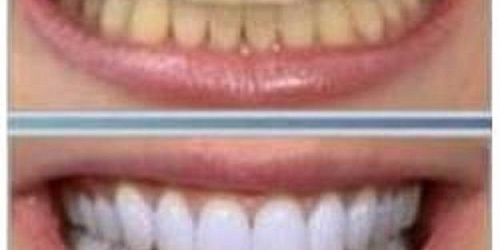 DENTISTA, DR. JULIO MANUEL ZAMARRIPA MIGUEL