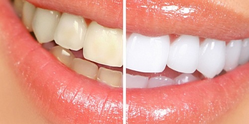 DENTISTA, DR. JULIO MANUEL ZAMARRIPA MIGUEL
