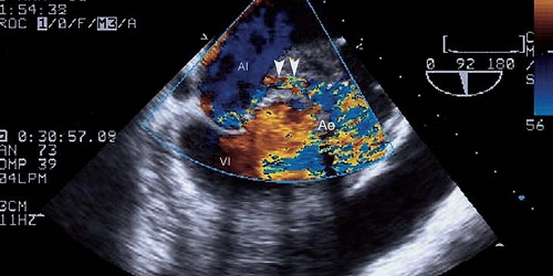 Dr. Iván G. Salazar M. CARDIOLOGO