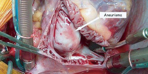 Dr. Iván G. Salazar M. CARDIOLOGO