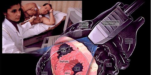 Dr. Iván G. Salazar M. CARDIOLOGO