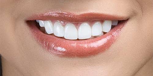 Dr. José Cedeño Bermeo - Rehabilitador Oral