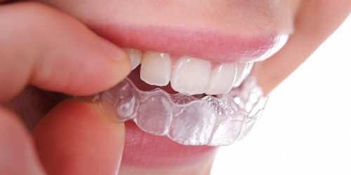 Dr. José Cedeño Bermeo - Rehabilitador Oral